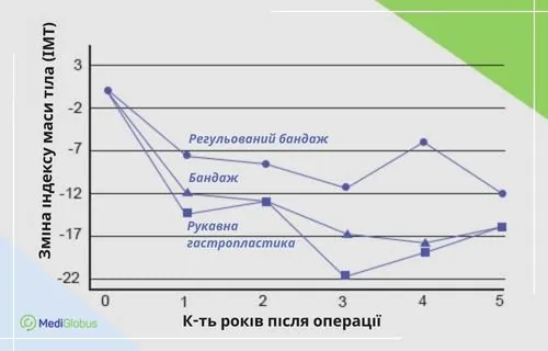 Ефективність баріатричних втручань: зміна ІМТ у п’ятирічній перспективі Графік зміни індексу маси тіла після баріатричних операцій: регульований бандаж, бандаж та рукавна гастропластика, дані за п’ять років