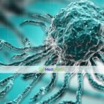 Насколько эффективно лечение рассеянного склероза стволовыми клетками?