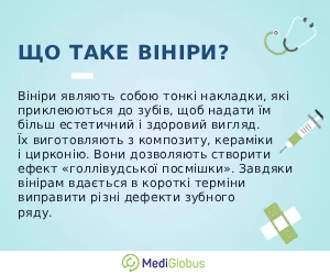veeneers_info_ukr Пояснення від стоматолога що таке вініри