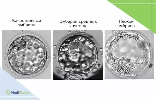 Качество ооцитов и эмбрионов — ключевой фактор успешности ЭКО Три микрофотографии эмбрионов на стадии бластоцисты: качественный, среднего качества и плохой эмбрион