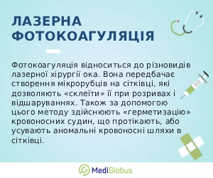 laser_photocoagulation_ukr Лазерна фотокоагуляція зору пояснення