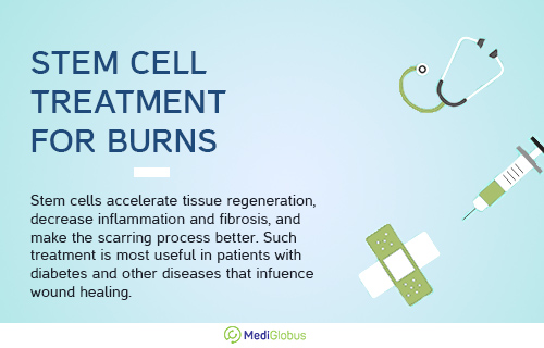 stem cell treatment for burns