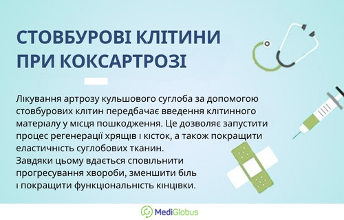 Лікування коксартрозу стовбуровими клітинами Інформація про лікування коксартрозу стовбуровими клітинами