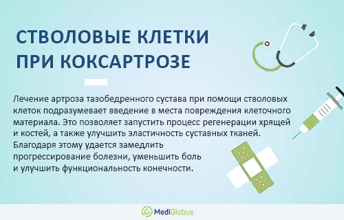 Информация про лечение коксартроза стволовыми клетками