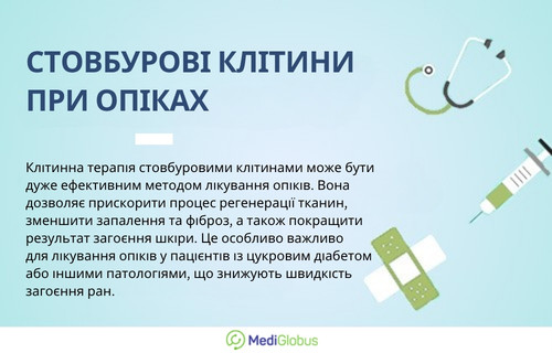 Інформація про застосування стовбурових клітин при опіках