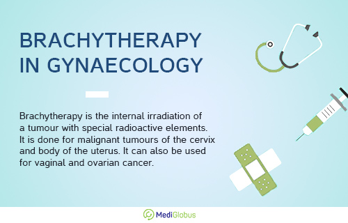 brachytherapy in gynaecology