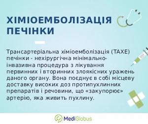 liver_chemoembolisation_ukr Що таке хіміоемболізація печінки пояснення