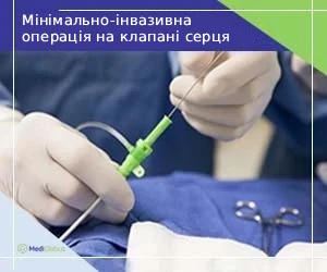 Minimally-invasive-surgery-for-m_ukr Мінімально-інвазивна операція на клапані серця