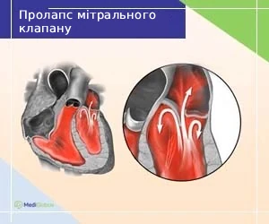 Mitral-valve-abnormalities_ukr Як виглядає пролапс мітрального клапану