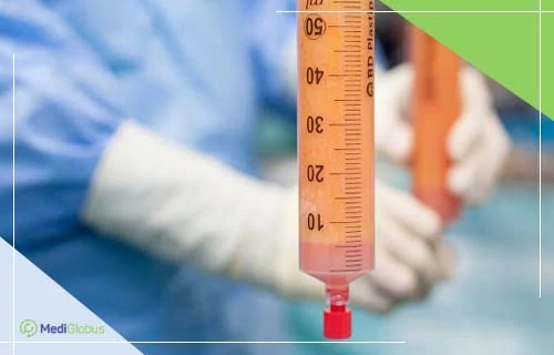 SVF-технология в спортивной медицине Большой шприц, наполненный эмульсией для проведения регенеративных процедур, таких как SVF-терапия (стромально-васкулярная фракция)