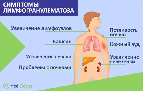 Схематическое изображение организма ребенка с обозначением симптомов при лимфогранулематозе
