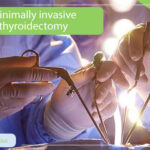 minimally invasive thyroidectomy