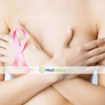 Подкожная мастэктомия - возможно ли сохранить грудь при раке молочной железы?