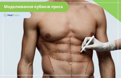 Моделювання кубиків преса Пластичний хірург наносить розмітку на живіт чоловіка перед пластичною операцією