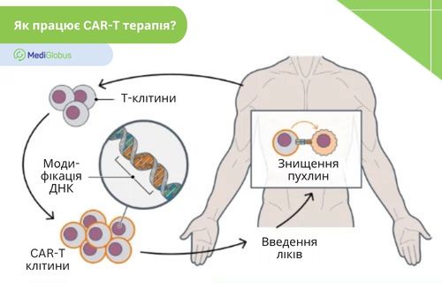 Інфографіка: Як працює CAR T-терапія