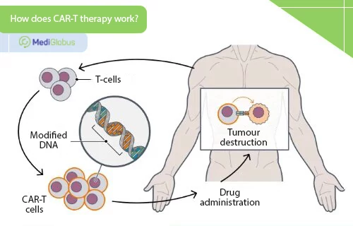 car-t therapy for multiple myeloma