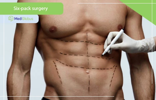 six pack surgery