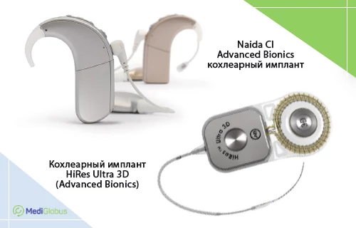 Кохлеарные импланты компании Advanced Bionics Компоненты системы кохлеарной имплантации компании Advanced Bionics, в частности речевой процессор Naída CI и имплант HiRes Ultra 3D.