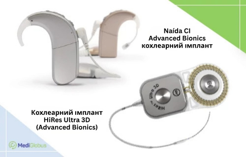 Кохлеарні імпланти компанії Advanced Bionics Компоненти системи кохлеарної імплантації компанії Advanced Bionics, зокрема мовний процесор Naída CI та імплант HiRes Ultra 3D.