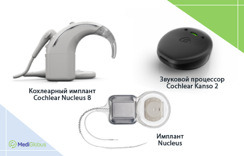 Сравнение лучших кохлеарных имплантов | Medical Tourism with MediGlobus ...