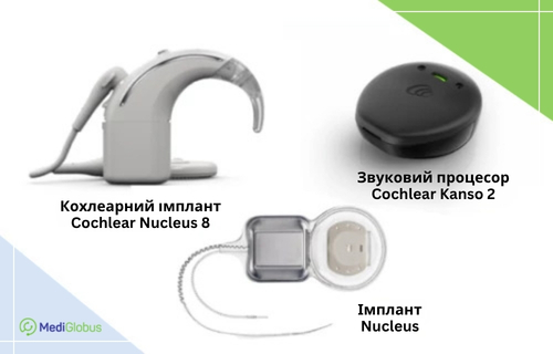 Кохлеарні імпланти Cochlear Компоненти кохлеарного імплантату Cochlear: завушний звуковий процесор Nucleus 8, круглий процесор Kanso 2 та внутрішній імплантат Nucleus з електродами.