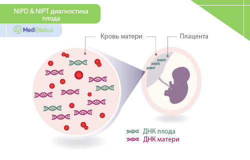 Неинвазивная пренатальная диагностика