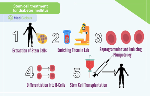 stem cell treatment stages for diabetes mellitus
