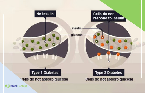 type 1 vs type 2 diabetes