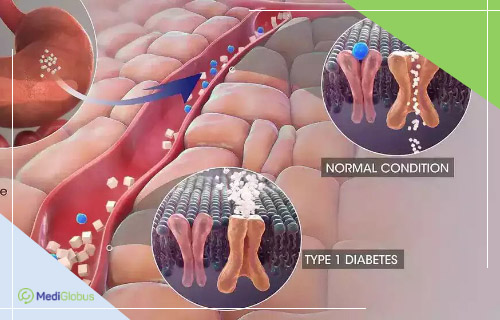 how do stem cells help with type 1 diabetes