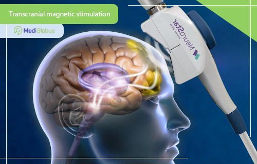 transcranial magnetic stimulation