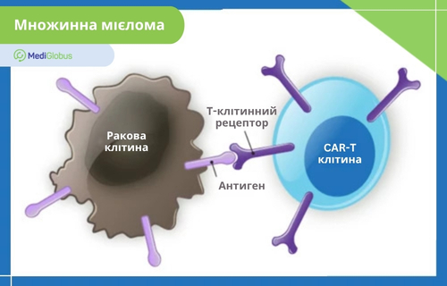 Лікування множинної мієломи за допомогою CAR-T-клітин Схема механізму дії CAR-T-терапії при множинній мієломі: модифікована CAR-T-клітина розпізнає антиген на поверхні ракової клітини та зв’язується з ним.