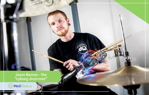 jason barnes - bionic prosthetic hand