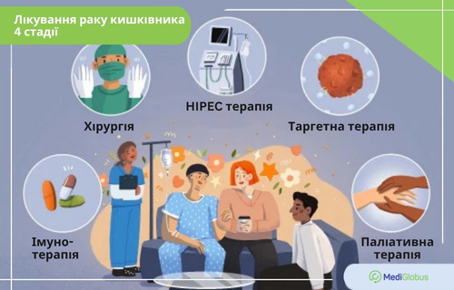 Як лікують рак кишечника на останній стадії Інфографіка: Сучасні методи лікування раку кишечника 4-ї стадії
