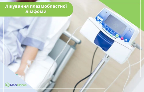 Лікування плазмобластної лімфоми У лікарняній палаті на ліжку лежить пацієнт, якому через катетер у руці встановлюють крапельницю. Праворуч на металевій стійці крупним планом зображено сучасний електронний інфузійний насос із кнопками керування та екраном. У лівому верхньому куті напис: «Лікування плазмобластної лімфоми».