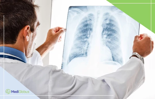 treatment of lung lymphoma