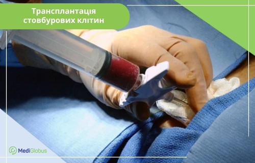 Трансплантація стовбурових клітин при плазмобластній лімфомі Медичний працівник у стерильних рукавичках тримає великий шприц із темно-червоною речовиною під час хірургічної або регенеративної процедури. Шприц підключений до катетера або порту на тілі пацієнта, накритого синіми операційними простирадлами. У лівому верхньому куті розташована плашка зеленого кольору з написом «Трансплантація стовбурових клітин»