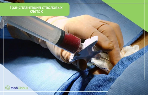 трансплантация стволовых клеток при плазмобластной лимфоме