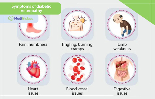 symptoms of diabetic neuropathy