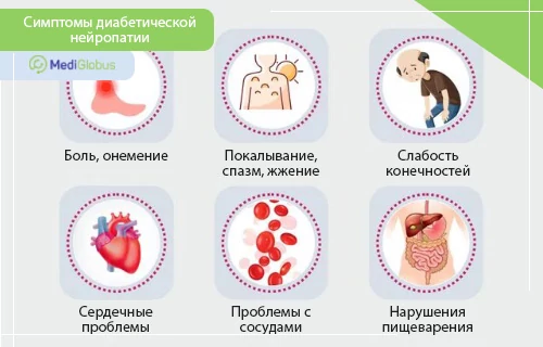 Симптомы диабетической нейропатии Инфографика "Симптомы диабетической нейропатии": боль, спазм, слабость, проблемы с сердцем и сосудами, нарушение пищеварения.
