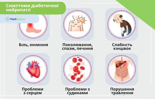 Симптоми діабетичної нейропатії Інфографіка «Симптоми діабетичної нейропатії»: біль, спазм, слабкість, проблеми з серцем і судинами, порушення травлення.