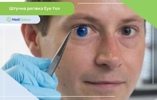 Штучна рогівка EyeYon Чоловік тримає пінцетом на рівні очей штучну рогівку