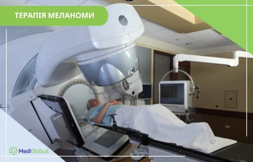Радіотерапія при меланомі Пацієнт проходить променеву терапію: лежить на столі під лінійним прискорювачем, поруч монітори та обладнання для контролю процедури