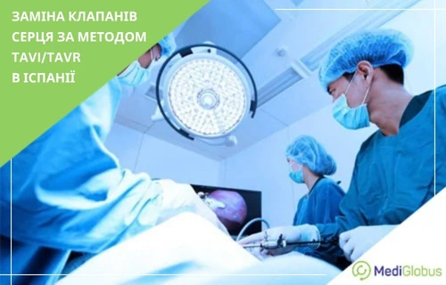 Транскатетерна заміна клапана серця в Іспанії хірурги проводять транскатетерну заміну серцевого клапана і дивляться на монітор