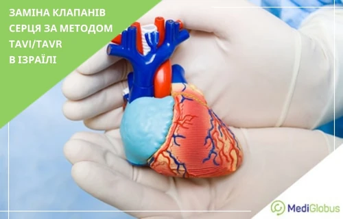 Транскатетерна заміна клапана серця в Ізраїлі хірург у стерильних рукавичках тримає на долонях анатомічну модель серця