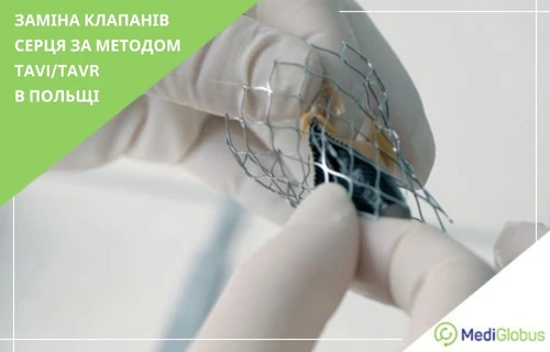 Транскатетерна заміна клапана серця в Польщі Лікар у рукавичках тримає металевий каркас транскатетерного аортального клапана для процедури TAVI/TAVR