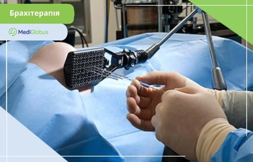 Види променевої терапії за джерелом випромінювання: брахітерапія Процедура брахітерапії — лікар встановлює джерело радіації поруч із пухлиною