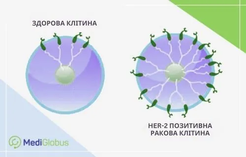Що таке HER-2 позитивний рак грудей? Схематичне порівняння двох клітин: ліворуч — здорова клітина з невеликою кількістю рецепторів HER-2, праворуч — HER-2-позитивна ракова клітина з безліччю зелених рецепторів на поверхні