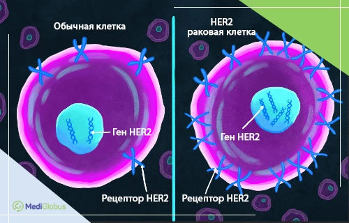 her2 положительный рак груди