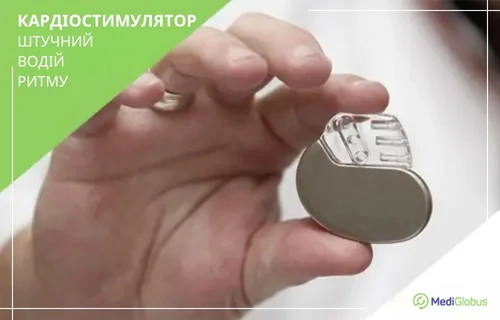 Як виглядає кардіостимулятор пристрій кардіостимулятора крупним планом