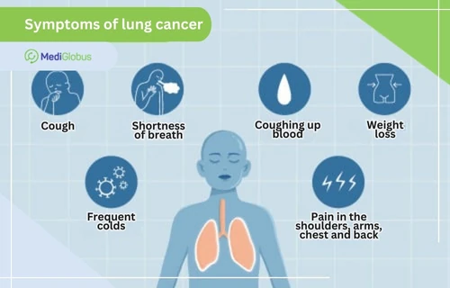 Infographic: Symptoms of lung cancer Infographic: Symptoms of lung cancer